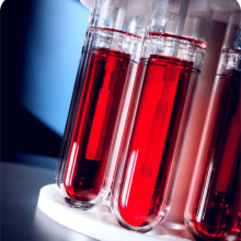 Celdas de Prueba SimAir® para ASTM D2983